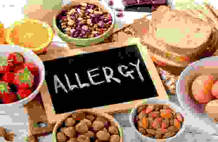 Food Allergy